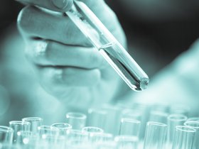 Bild Forschungsschwerpunkte Innere Medizin I